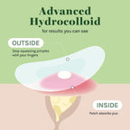 Absorbing Cover Healing Invisible Acne Patch Blemish Spot, Treatment, Facial Acne Patch Vegan, Cruelty Free, Hydrocolloid, Two Sizes 10mm 12mm (Total 84 Counts)