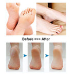 Foot Scrubber Electric Callus Remover Rechargeable Foot File Hard Skin Remover Pedicure Tools Electronic Callus kit for Cracked Heels and Dead Skin with 2 Roller Heads, Blue